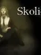 Skolios
