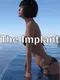 The Implant