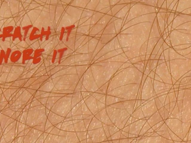 Itch