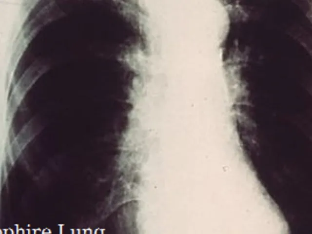 Sapphire Lung