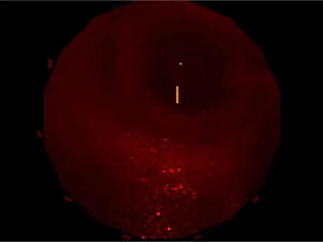 Submergent